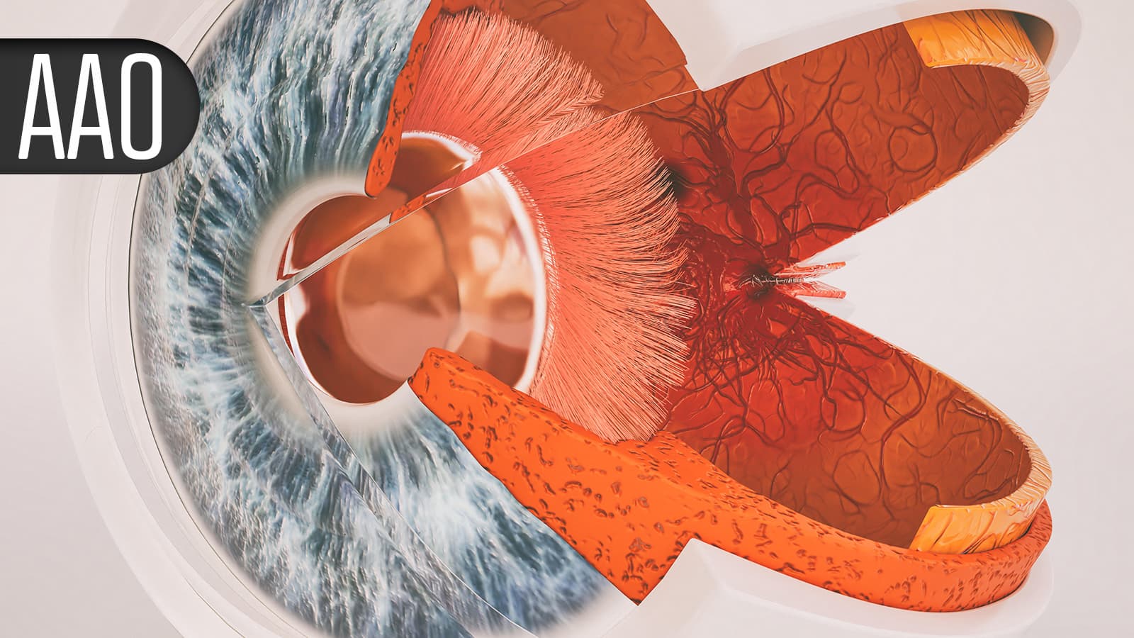 Sleep Apnea in Young Children May Boost Glaucoma Risk